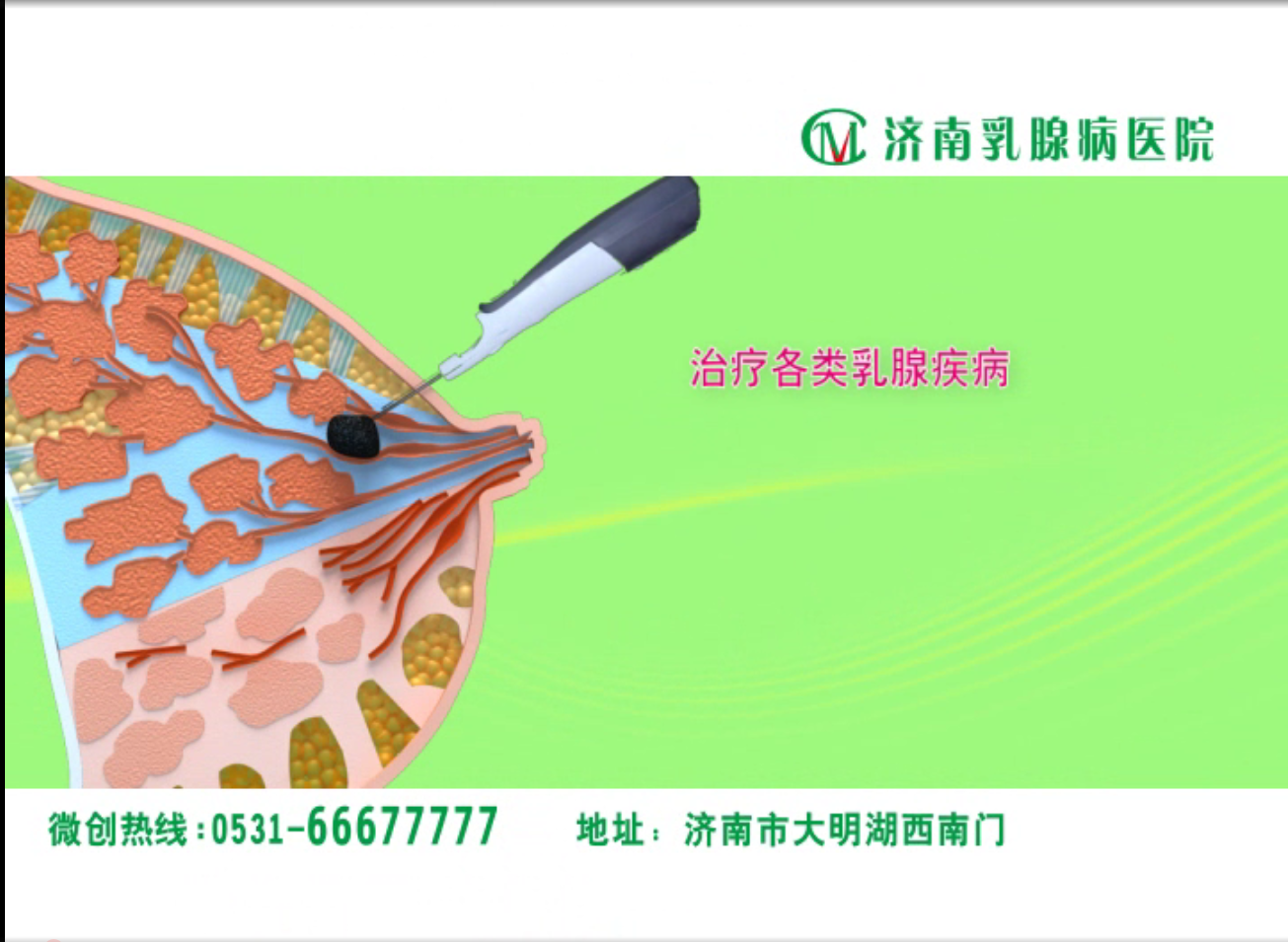 動(dòng)畫(huà)視頻是提高患者參與度的好方法